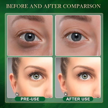 Well Arive™ Avocado Moisturizing Collagen Eye bag mask